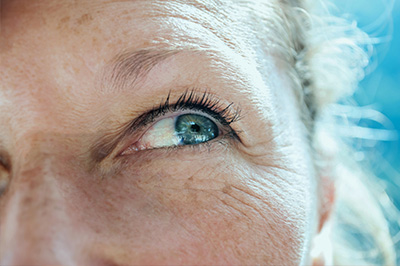 Cataracts Treatment in 07856
